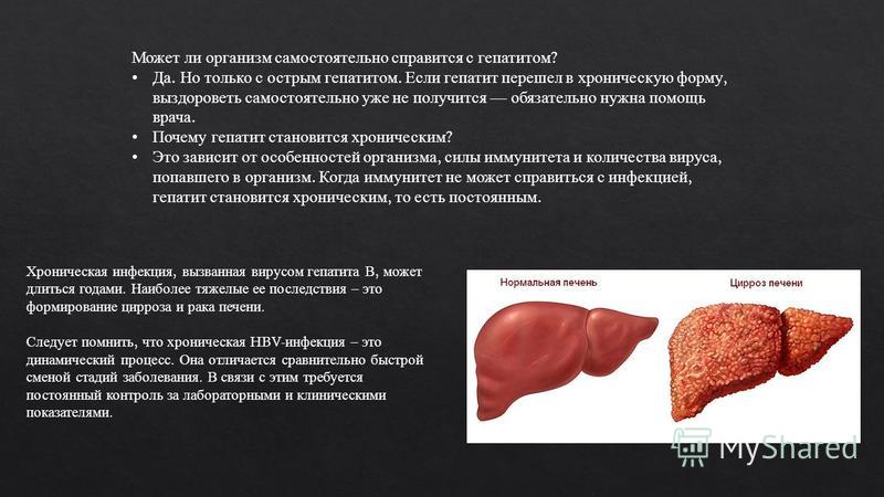 Сколько живут с гепатитом с. Хронический гепатит и цирроз печени. Цирроз при вирусных гепатитах. Переход гепатита в цирроз Триада. Цирроз печени и гепатит различия.