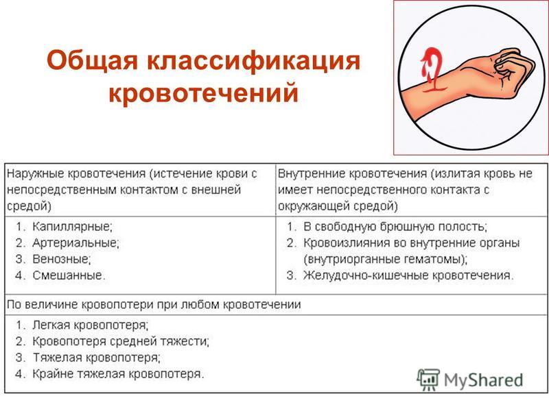 Виды кровотечений признаки первая помощь таблица 8. Классификации наружного кровотечения. Артериальное кровотечение классификация. Классификация РАН И кровотечений. Классификация кровотечений капиллярное.