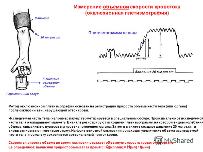 Определение скорости кровотока в сосудах. Методы измерения объемной скорости кровотока. Импедансная окклюзионная плетизмография. Ультразвуковой метод определения скорости кровотока схема. Линейная скорость кровотока методы измерения.