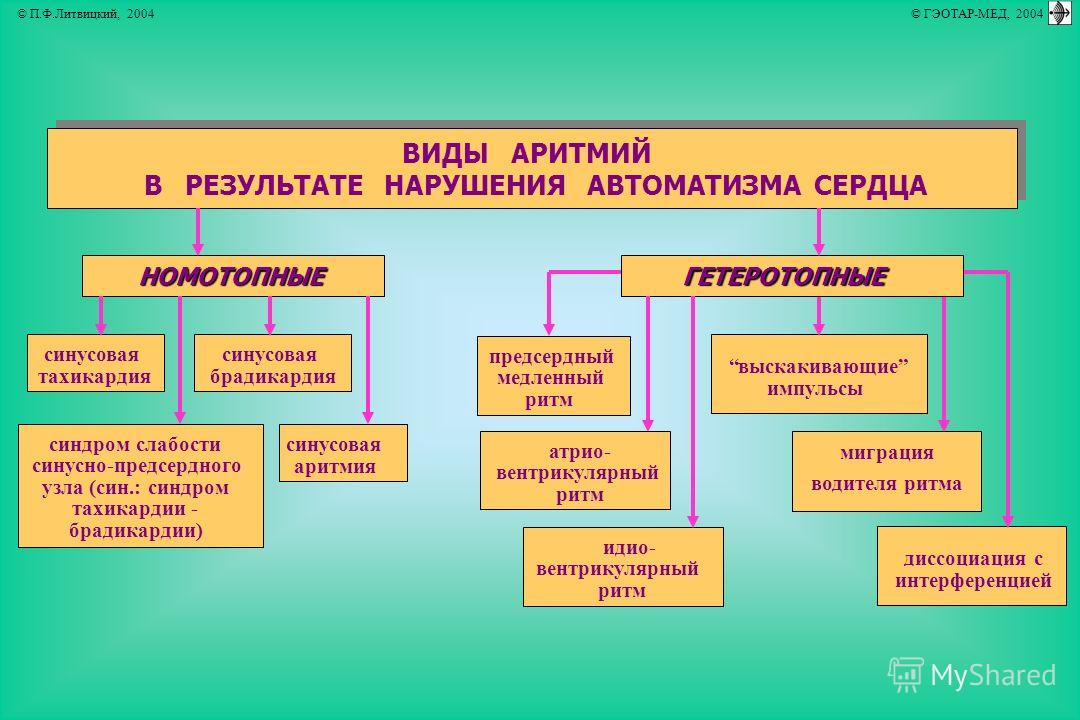 Блок схема классификация аритмий