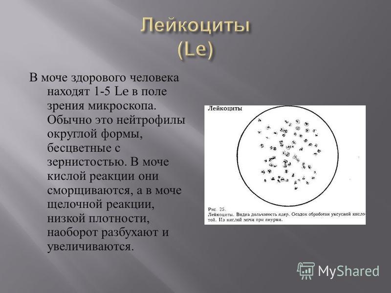 Лейкоциты в моче норма в поле зрения