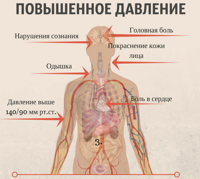 Симптоматика повышенного АД