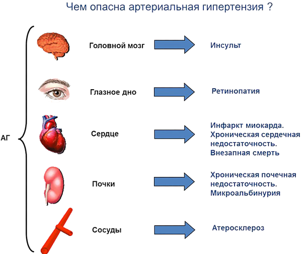 Последствия артериальной гипертензии: для головного мозга - инсульт; для глазного дна - ретинопатия; для сердца - инфаркт миокарда, хроническая сердечная недостаточность, внезапная смерть; для почек - хроническая почечная недостаточность, микроальбинурия; для сосудов - атеросклероз