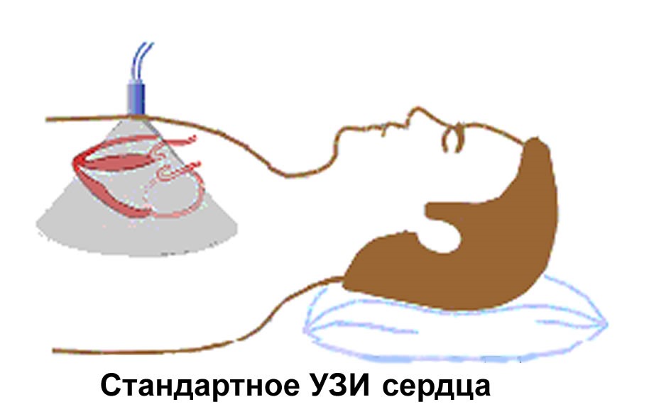 ЭХО КГ сердца на схеме