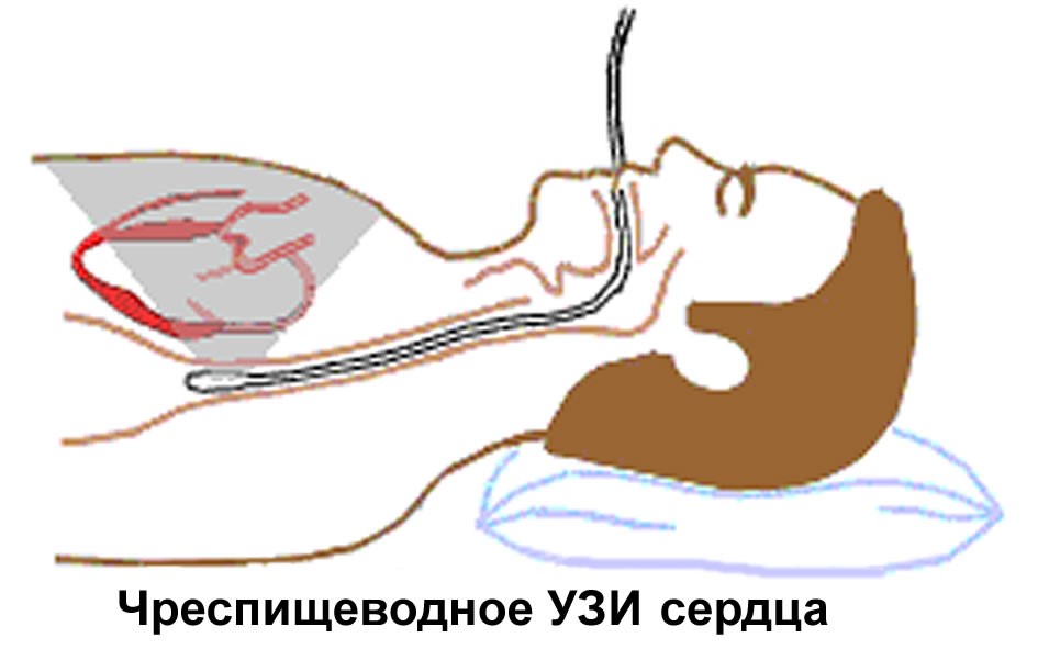 Исследование сердца на схеме