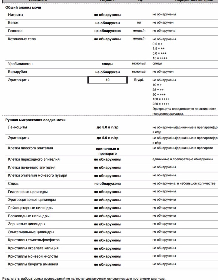 Анализ мочи на мочевую кислоту