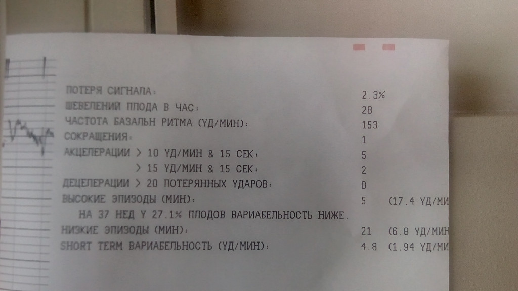 Ктг на 39 неделе беременности. КТГ при беременности расшифровка 37 недель норма. Плохое КТГ на 37 неделе беременности. КТГ нормальные показатели на 37 неделе. Вариабельность коротких интервалов КТГ норма.