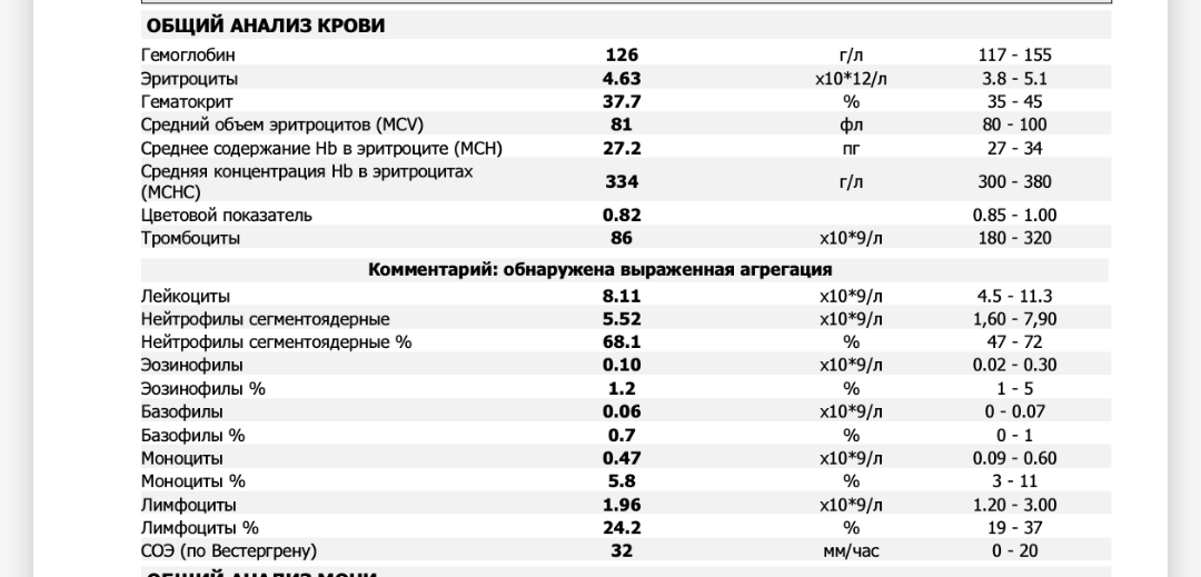 Опель вектра б повышенное со причины