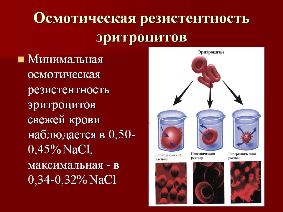 резистентность эритроцитов