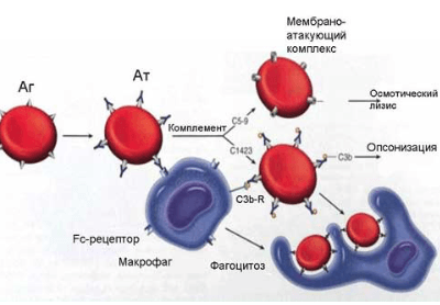 Гемолитическая анемия