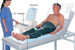 Процедура проведения ЭКГ сердца