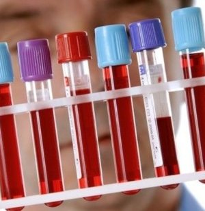 D-димер при беременности: 1, 2, 3-й триместры, норма по неделям