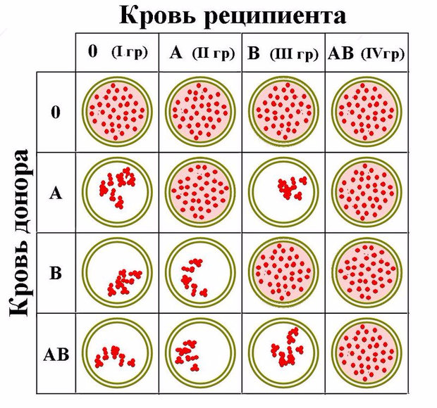 Результат агглютинации несовместимых групп крови