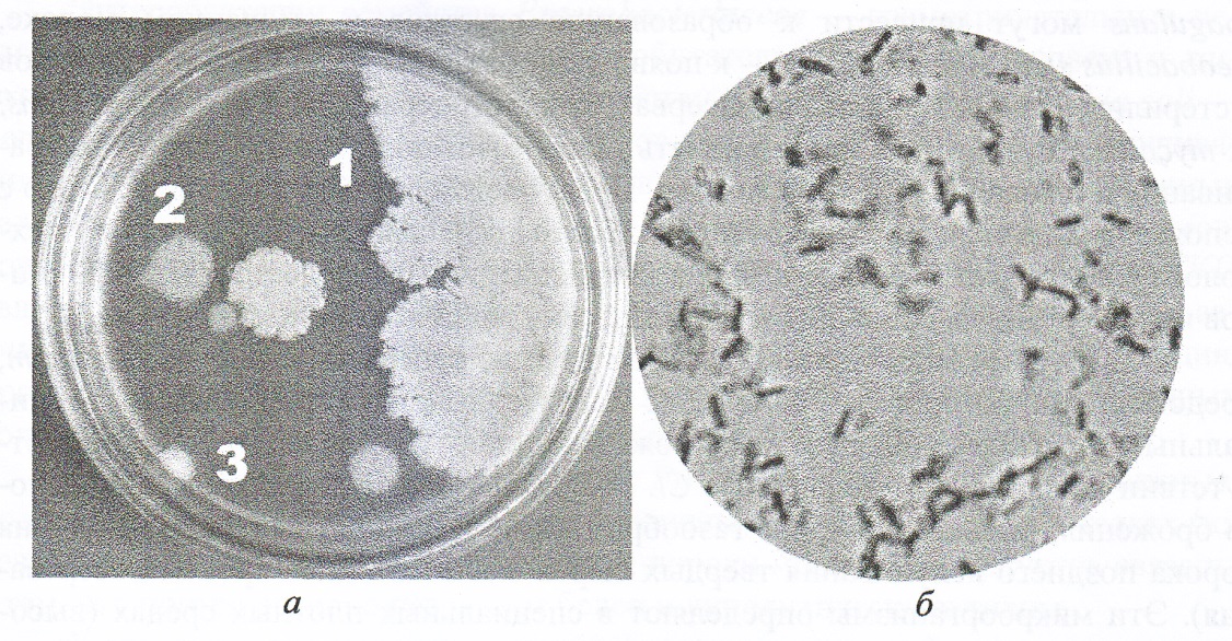 Кмафанм в микробиологии. Спорообразующие клостридии микробиология. Колонии клостридий на МПА. Мезофильные аэробные бактерии это.
