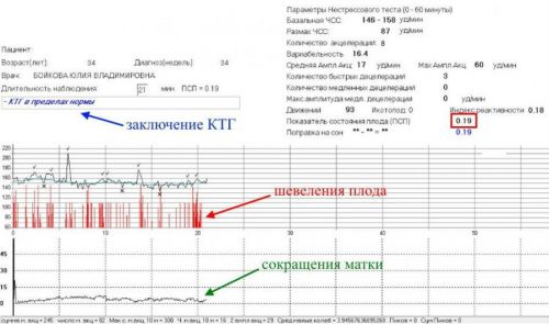 КТГ плода