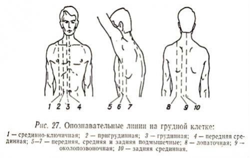 Опознавательные линии на грудной клетке