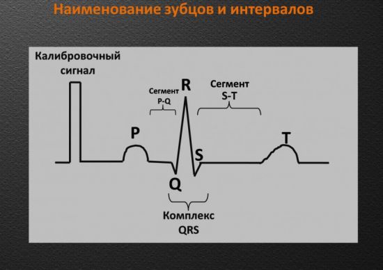 Зубцы и интервалы на ЭКГ