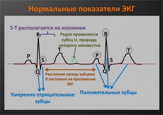 Нормальные показатели ЭКГ