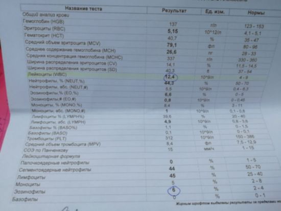 Результат анализа крови