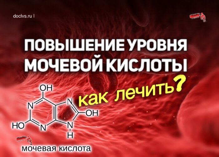 Мочевая кислота повышена что пить. Повышение мочевой кислоты. Причины повышения мочевой кислоты. Повышенная мочевая кислота у мужчин. Факторы вызывающие повышение мочевой кислоты.