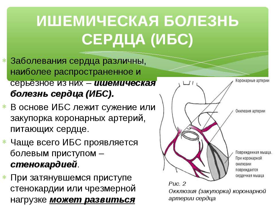 Ишемическая болезнь сердца лечение