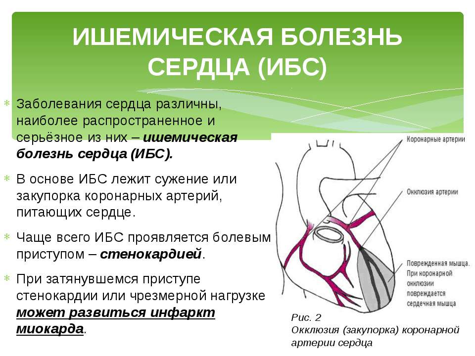 Болезни сердца презентация