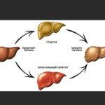Симптомы нарушений в работе печени