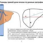 Какие размеры печени должны быть в норме по УЗИ?