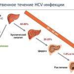 Можно ли вылечить активный хронический гепатит?