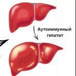 Что такое гепатит: симптомы и лечение заболевания в разной форме