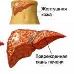 Симптомы болезни печени и поджелудочной железы