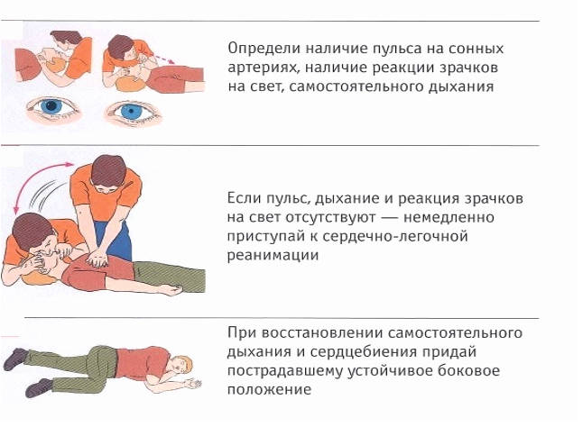 Действия при острой сердечной недостаточности