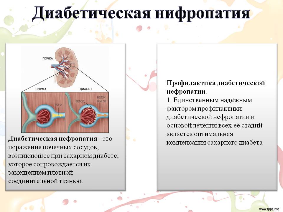 Фото диабетическая нефропатия