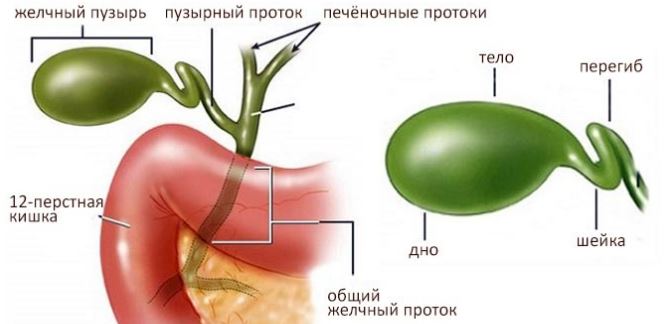 Перегиб желчного пузыря