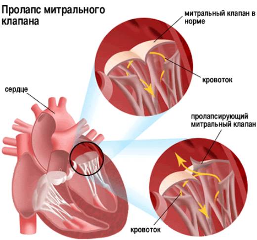 ПМК