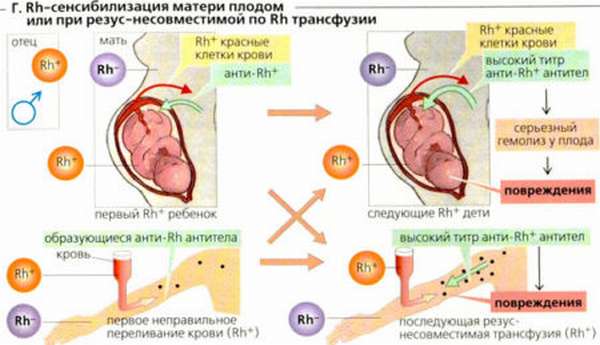 Характеристика отрицательного резус-фактора у женщин при беременности, что нужно учесть при постановке на учет?