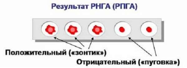 Как расшифровывается РПГА анализ крови и каким образом к нему подготовиться?