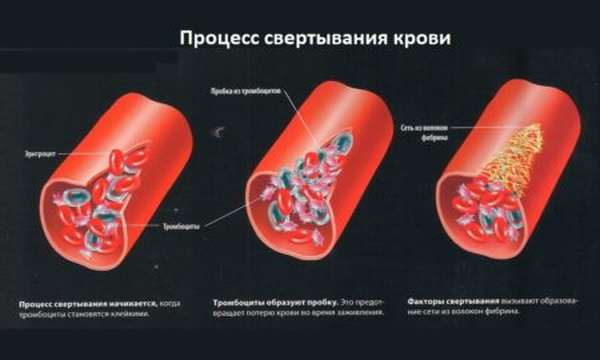 Нормы свертываемости крови у детей, методы определения и трактовка