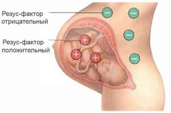 Совместимость 3 отрицательной группы крови с другими группами, резус-фактор и его влияние