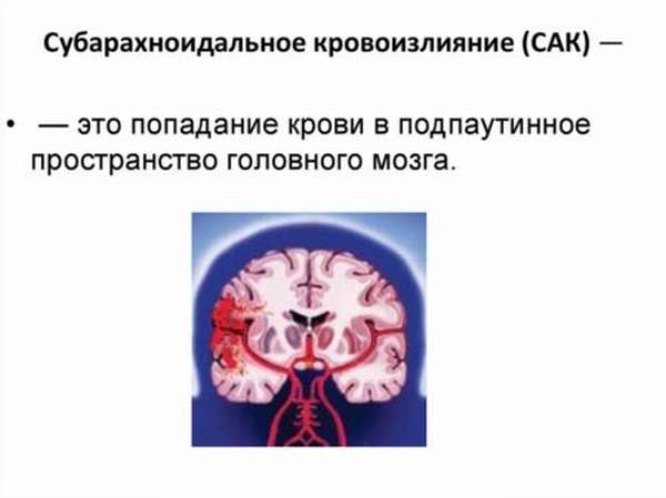 Почему после инсультов больные все время спят, последствия и отклонения