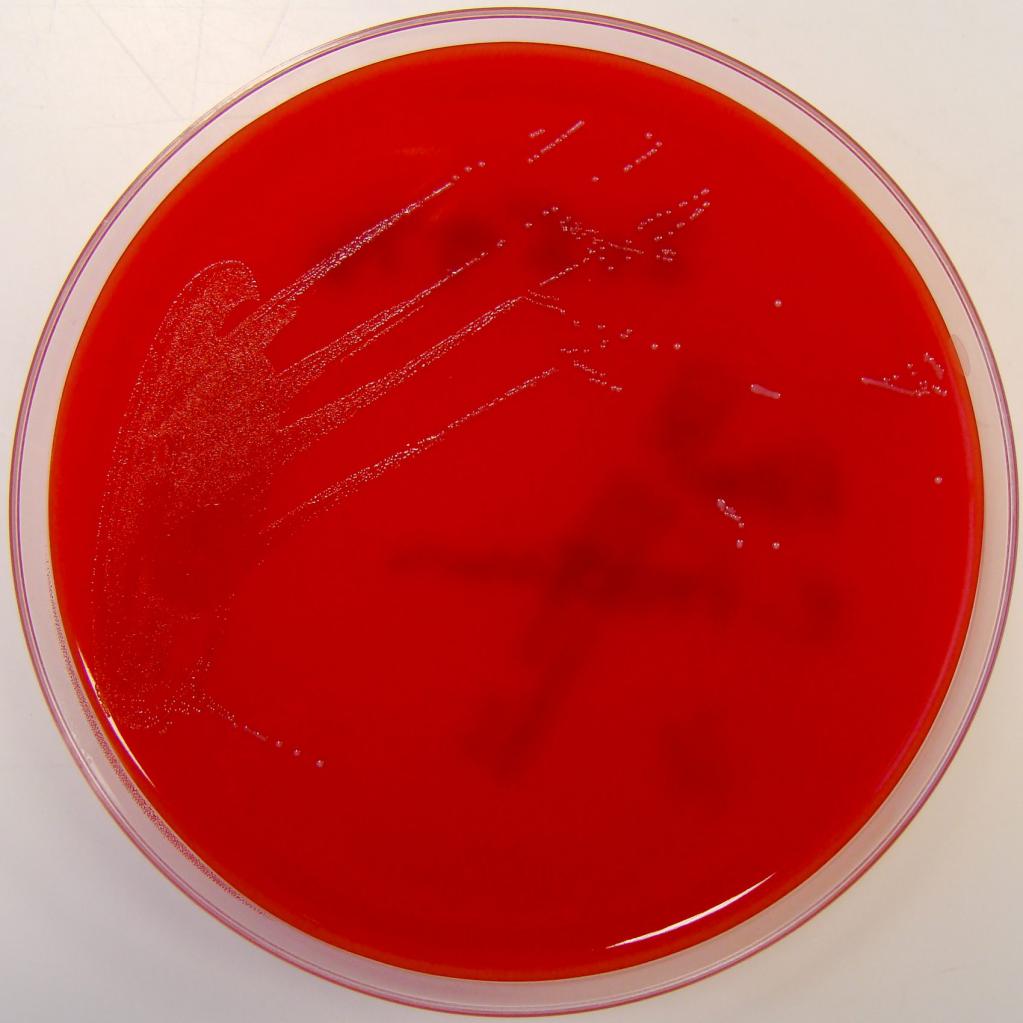 энтерококкус фециум enterococcus faecium лечение в мазке