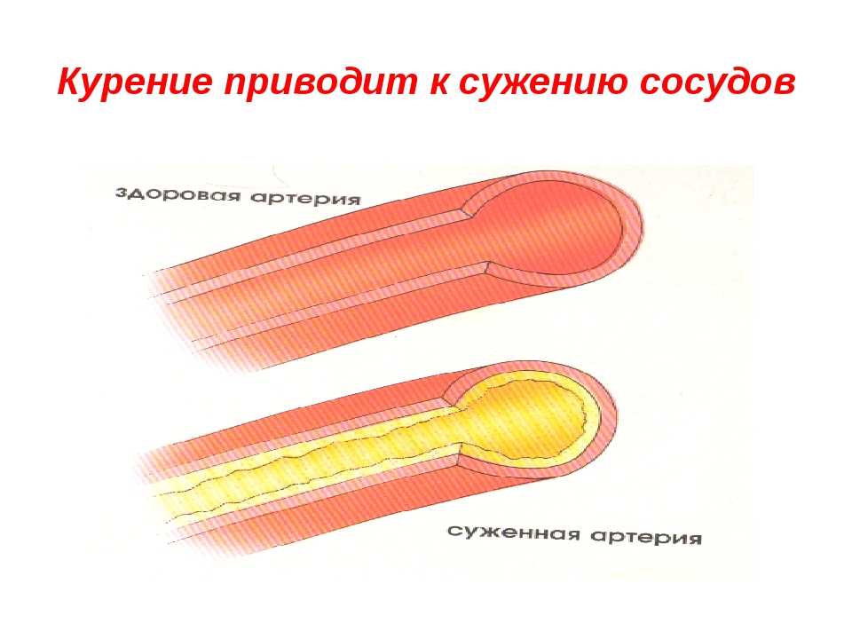 Расширить суженный сосуд. Воздействие никотина на сосуды. Воздействие курения на сосуды.