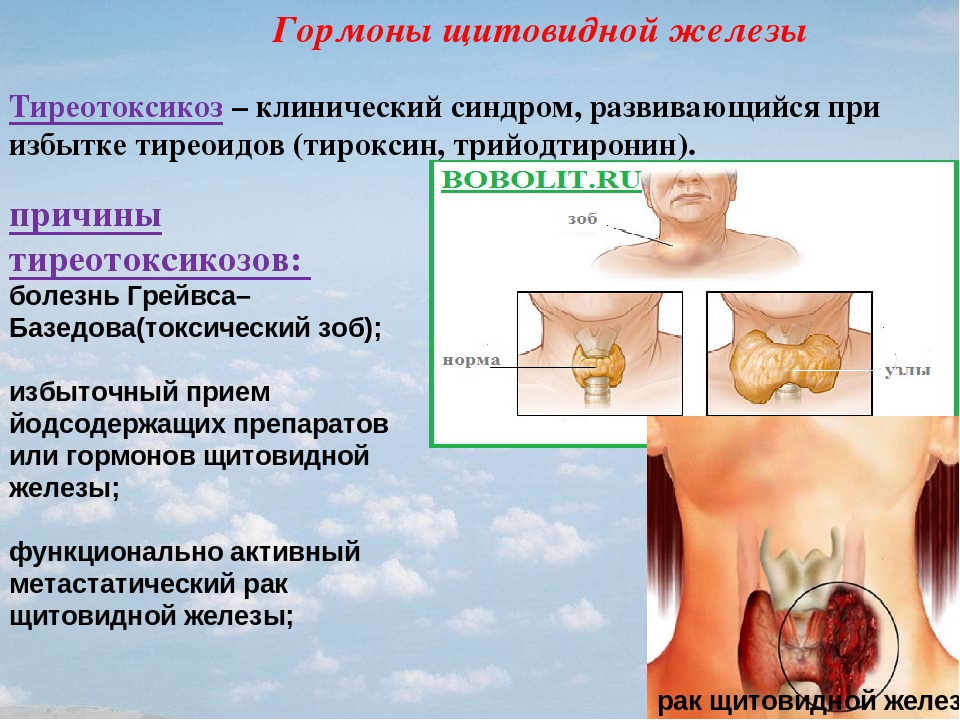 Гормоны щитовидной железы картинки