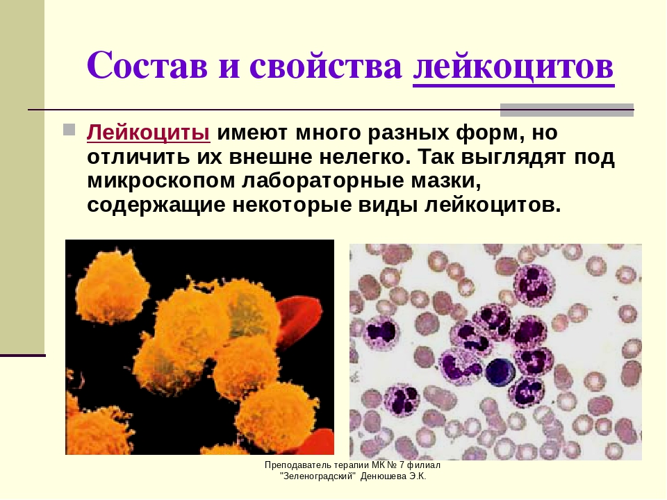 Лейкоциты как выглядят на картинке