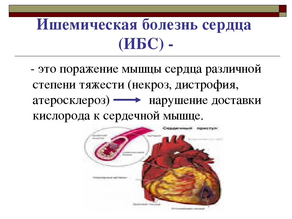 Стадии ИБС. Степени болезни сердца. Болезнь сердца 3 стадии. Ишемическая болезнь сердца.