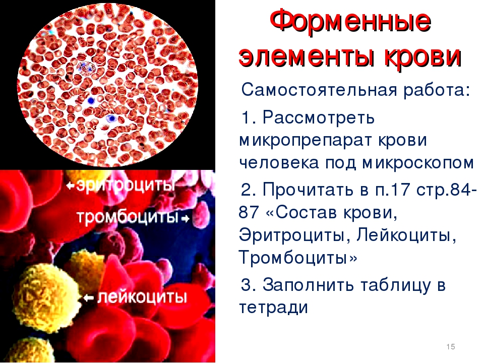 Назовите элементы крови. Форменные элементы крови лейкоциты. Форменные элементы крови тромбоциты. Форменные элементы крови гистология лейкоциты. Форменные элементы крови кровяные пластинки.