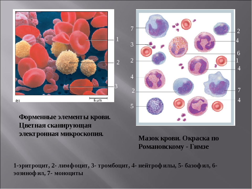 Форменные элементы формы. Мазок периферической крови с микроскопией. Мазок крови: эритроциты, лимфоциты, нейтрофилы, тромбоциты, моноциты.. Форменные элементы крови под микроскопом гистология. Лимфоциты в крови гистология.