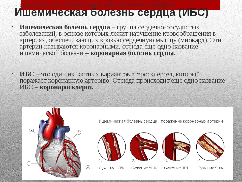 Чем опасна ишемия. Ишемическая кардиомиопатия. Ишемическая болезнь сердца биохимия. Ишемическая миокардиопатия.