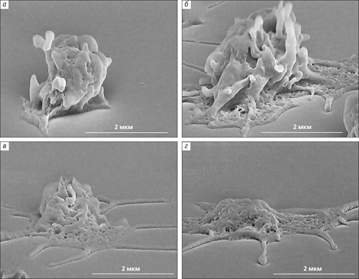 Рис. 5. Сканирующие электронные микрофотографии процесса распластывания активированного тромбоцита по поверхности («Природа» №2, 2014)