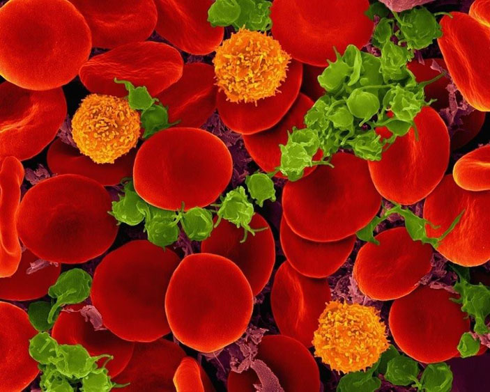 Как тромбоциты ускоряют свёртывание крови. Фото: Dennis Kunkel Microscopy Inc. («Наука и жизнь» №10, 2016)